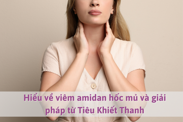 Hiểu về viêm amidan hốc mủ và giải pháp từ Tiêu Khiết Thanh