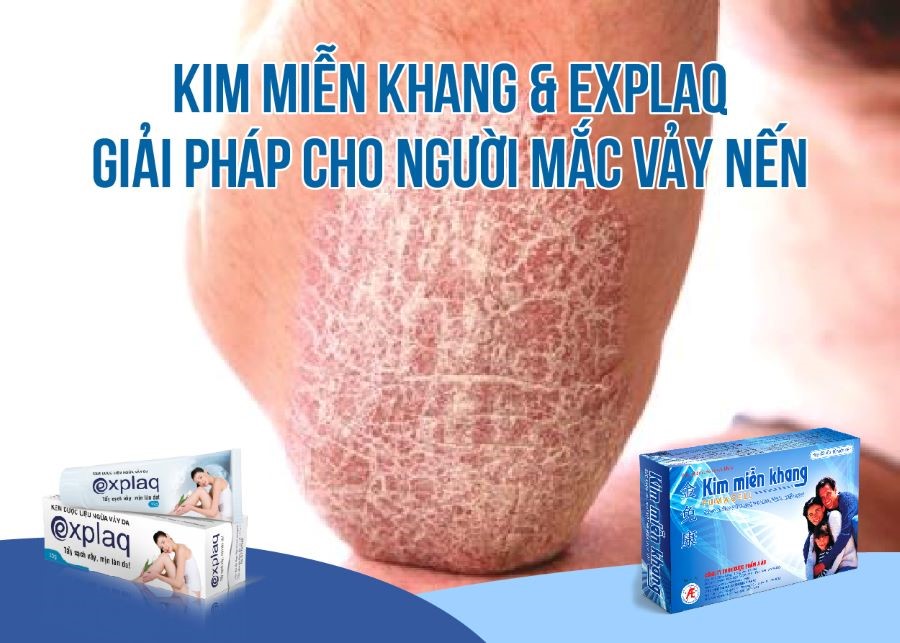 Các thể bệnh vảy nến và giải pháp từ Kim Miễn Khang