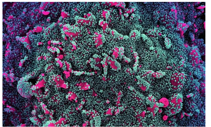 Biến thể JN.1 của virus SARS-CoV-2 gia tăng trên toàn cầu