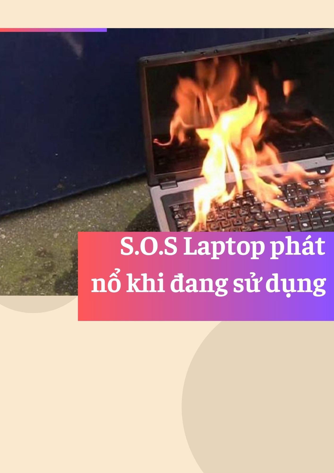 Laptop phát nổ bé trai 8 tuổi tại Bắc Giang nhập viện cấp cứu