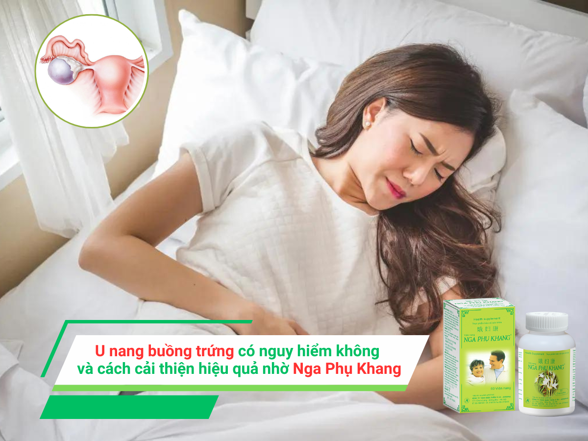 U nang buồng trứng có nguy hiểm không và cách cải thiện hiệu quả nhờ Nga Phụ Khang