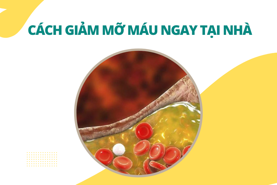 Cách giảm mỡ máu ngay tại nhà và giải pháp từ Lipidcleanz