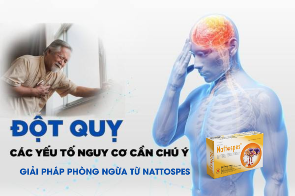 Yếu tố nguy cơ gây đột quỵ và giải pháp phòng ngừa từ Nattospes