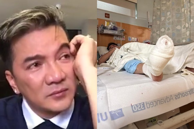 Đàm Vĩnh Hưng công khai đi diễn trở lại sau tuyên bố cụt 4 ngón chân