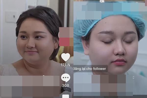 Trúc Anh Mắt Biếc phẫu thuật thẩm mỹ để gầy hơn