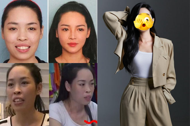 Sốc diện mạo hot girl thẩm mỹ Vũ Thanh Quỳnh sau màn đập mặt xây lại chấn động MXH