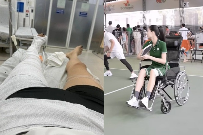 Kỳ Hân giải thích lý do gãy xương đùi vẫn ngồi xe lăn chơi pickleball