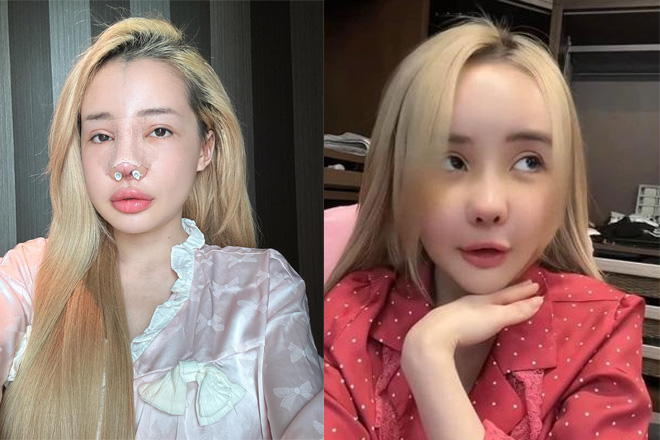 Ngân 98 chuẩn bị đập mặt xây lại lần thứ 12, ngoại hình hiện tại gây sốc