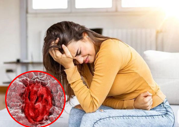 Bác sĩ cảnh báo Dấu hiệu sớm của ung thư trực tràng, 5 bất thường trên cơ thể tuyệt đối đừng bỏ qua!