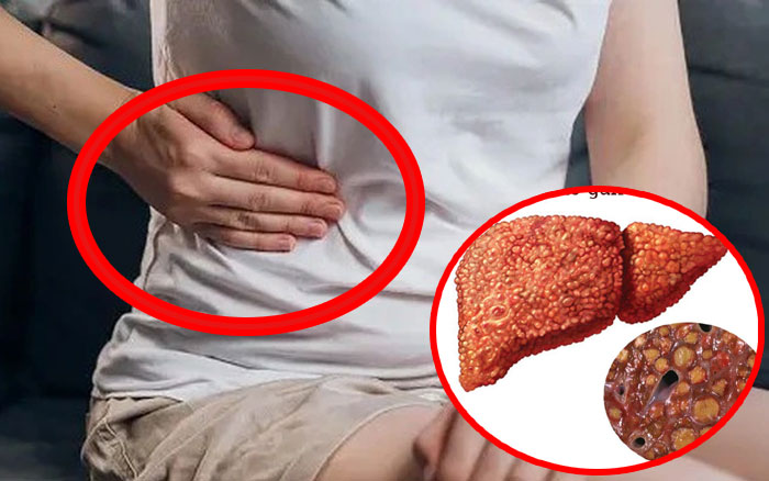 3 thói quen sau khi thức dậy có thể gây hại cho gan nhiều hơn cả uống rượu! Người gan kém thay đổi càng sớm càng tốt