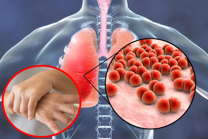 Phổi có khỏe hay không, nhìn tay là biết! Người bệnh phổi có 5 dấu hiệu bất thường ở tay, hãy tự kiểm tra