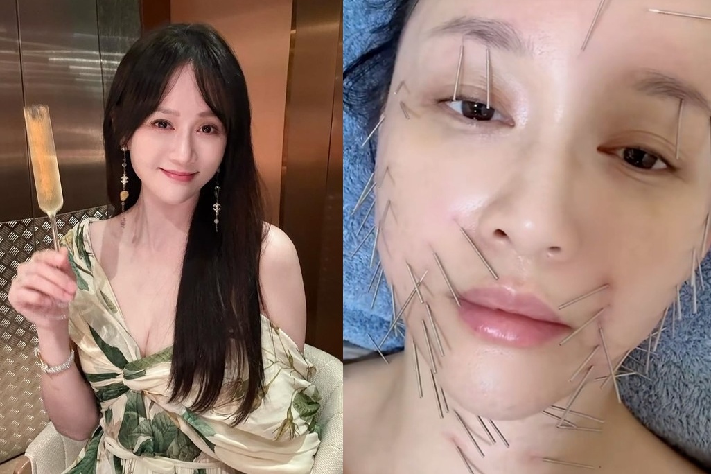 Trần Kiều Ân gây shock với bí quyết trẻ mãi không già Nguy hiểm và đầy đau đớn