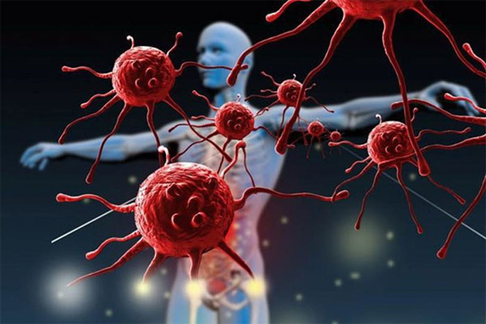 Nghiên cứu phát hiện Người ít nguy cơ mắc khối u ác tính thường có 5 thói quen này, bạn có không