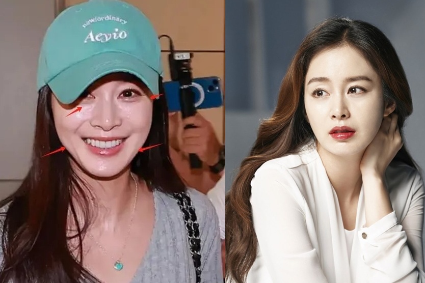  Kim Tae Hee nói về gương mặt cứng đờ, nhan sắc xuống cấp