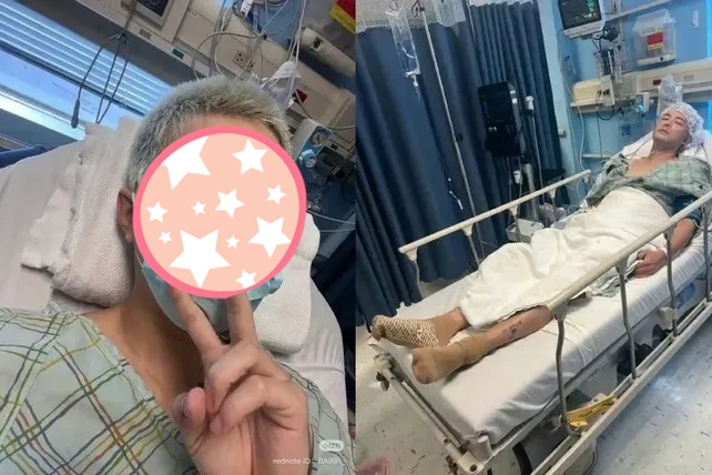 Vụ tai nạn khiến nam diễn viên nổi tiếng nát chân, nằm liệt giường