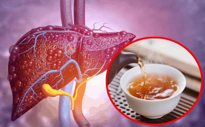 4 loại trà đã bị liệt vào danh sách đen hại gan, uống nhiều gây tổn thương gan, đặc biệt người cao tuổi cần lưu ý