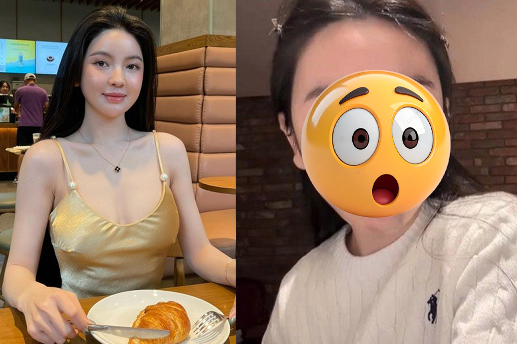 Vợ Quang Hải bị biến chứng thẩm mỹ phải sang Hàn Quốc điều trị, diện mạo hiện tại gây sốc