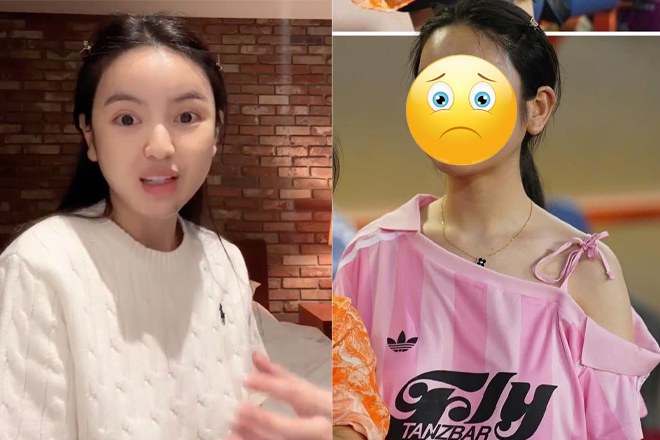 Giật mình diện mạo vợ Quang Hải qua cam thường trước khi tiết lộ bị biến chứng thẩm mỹ