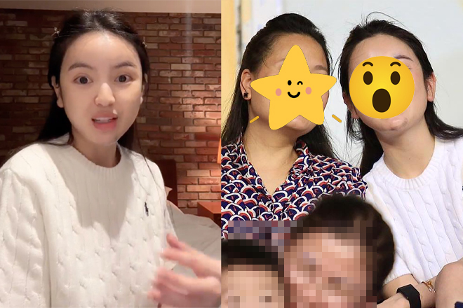 Chu Thanh Huyền lộ diện sau tiết lộ bị biến chứng thẩm mỹ, diện mạo cam thường gây ngỡ ngàng