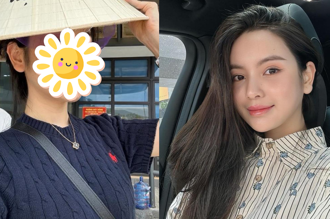 Mặt mộc gây xôn xao của Chu Thanh Huyền sau n lần thẩm mỹ, thậm chí bị biến chứng