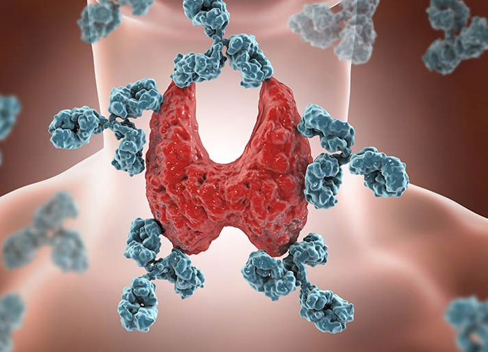 Bác sĩ cảnh báo 4 thói quen âm thầm hủy hoại tuyến giáp, nhiều người thường xuyên làm mà không biết