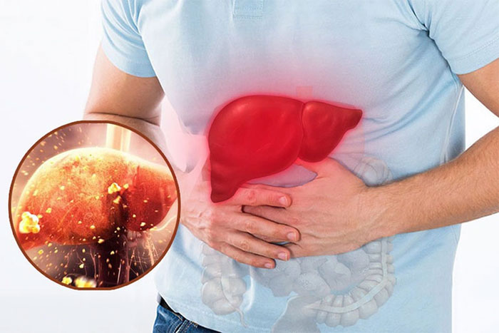 Nếu có ba bất thường ở bàn chân, khả năng cao gan thận có vấn đề! Khám càng sớm càng tốt