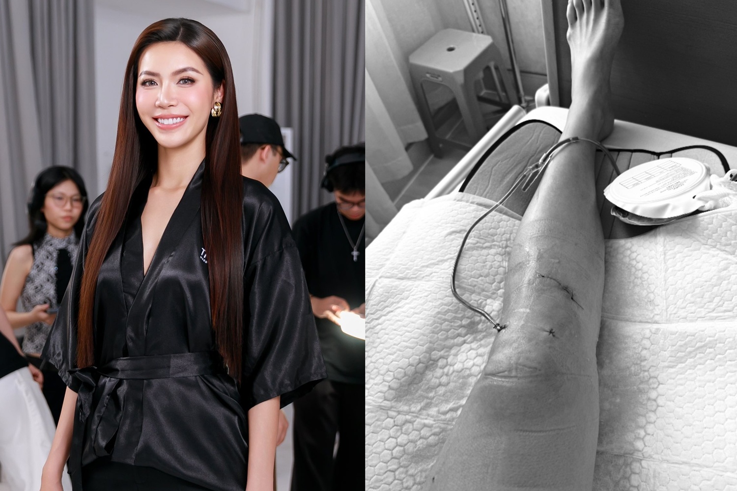 Minh Tú bị chấn thương nghiêm trọng Dập xương, rách sụn, đứt dây chằng