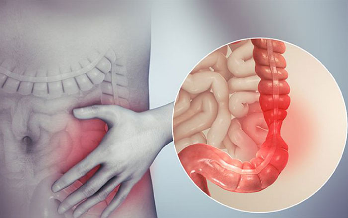 Kẻ thù của táo bón đã được tìm thấy! Không phải mật ong hay chuối, chỉ một động tác nhỏ giúp đại tiện thông suốt