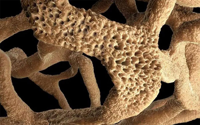 Loãng xương không phải do uống ít sữa! 8 loại thực phẩm ăn cắp canxi, hãy cẩn thận với xương giòn