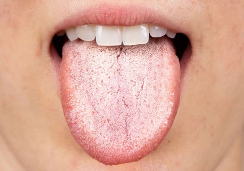 Lưỡi cho biết bạn khỏe mạnh hay không! Xuất hiện 3 dấu hiệu này, rất có thể gan hoặc dạ dày đang kêu cứu!