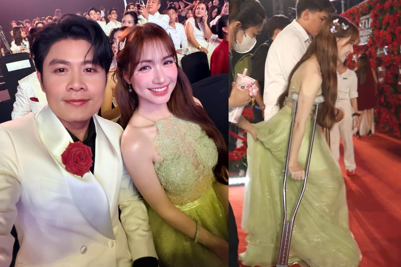 Hòa Minzy chống nạng đến sự kiện, xe lăn phải theo sau, chuyện gì đang xảy ra