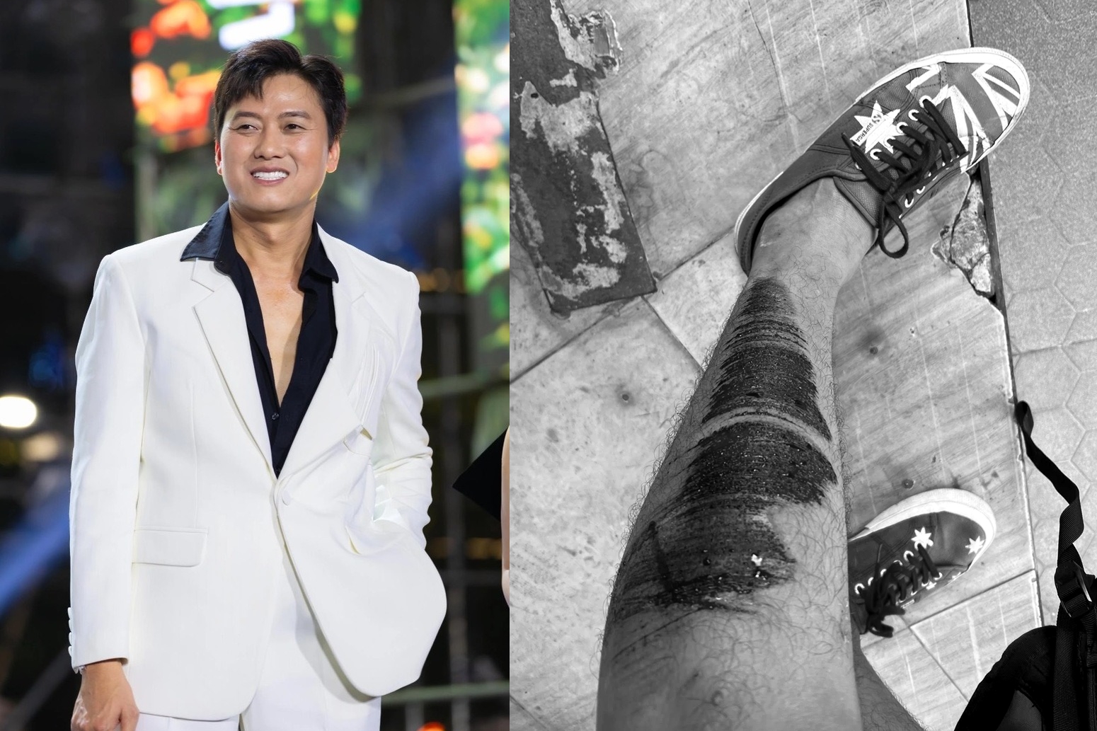 Nam diễn viên nổi tiếng Vbiz bị tai nạn, kể lại khoảnh khắc kinh hoàng