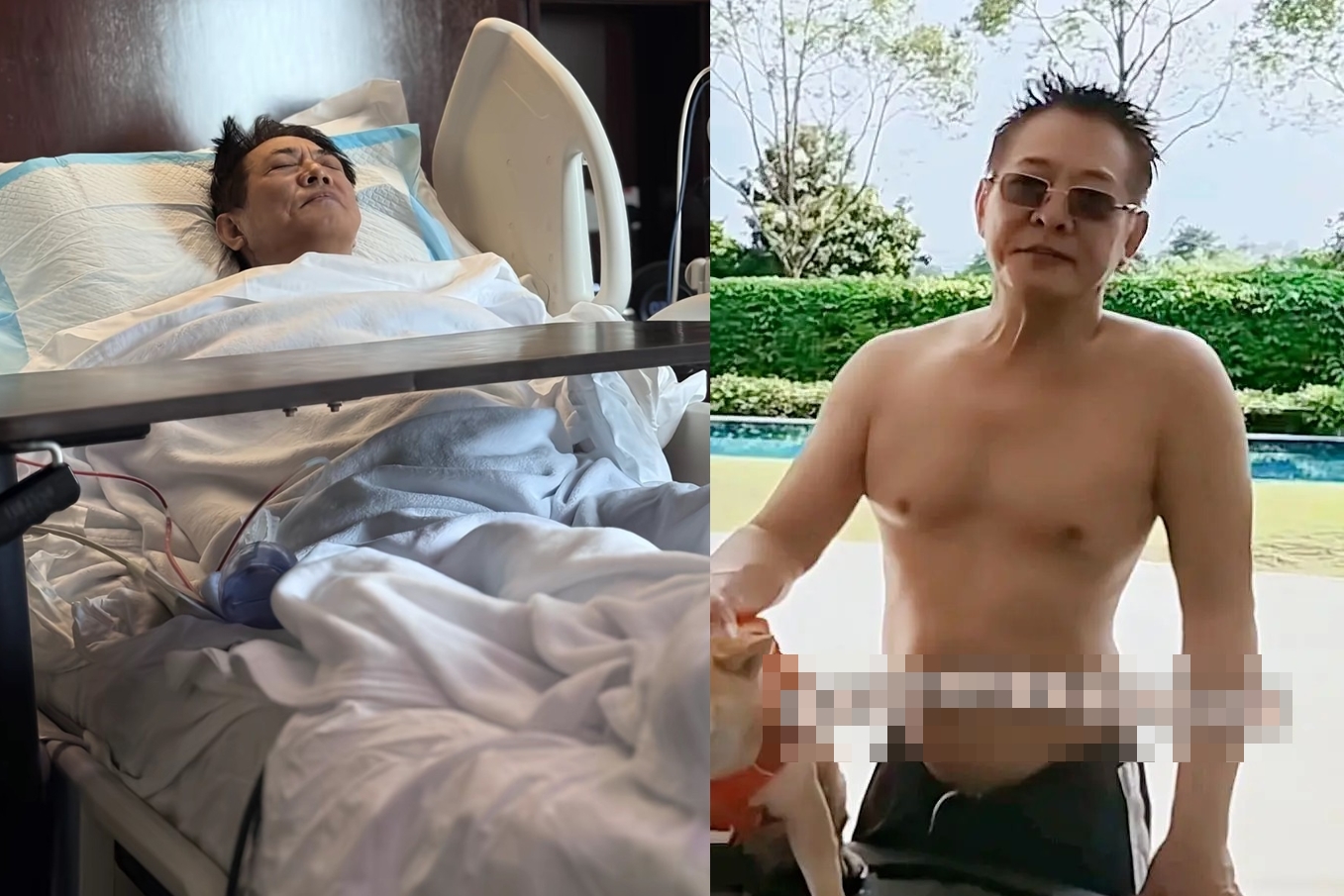 Rùng rợn tin đồn Lý Liên Kiệt thay tim để trẻ hóa, lột xác ngoại hình