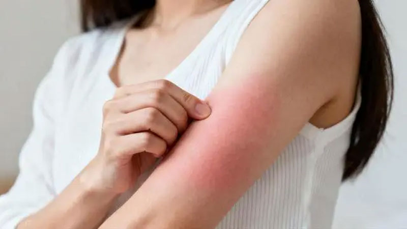 Bác sĩ Bệnh thận giai đoạn đầu không biểu hiện bằng phù nề mà chỉ có 3 bất thường chính