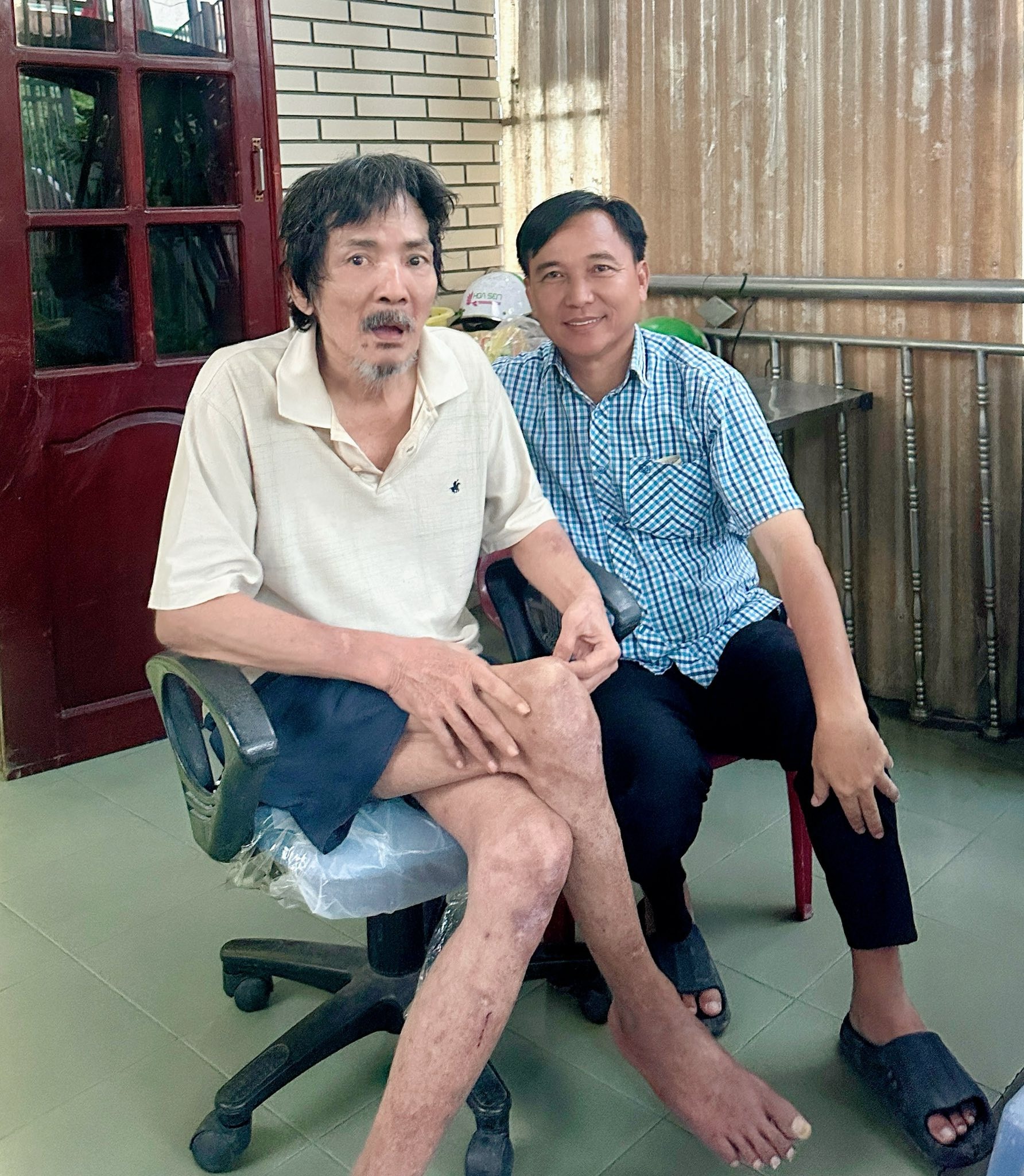 Những hình ảnh cuối đời bệnh tật, khốn khó của nghệ sĩ Thương Tín