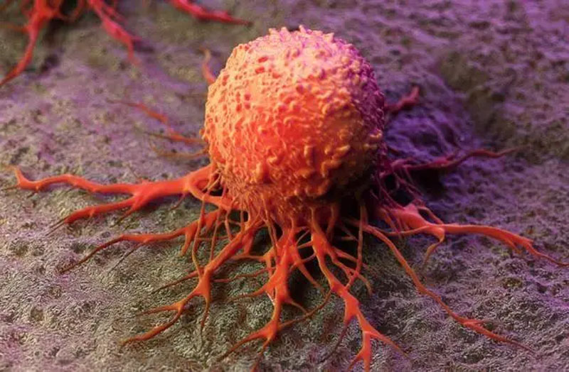 3 loại thịt là sát thủ ung thư, ăn càng nhiều càng dễ mắc bệnh!