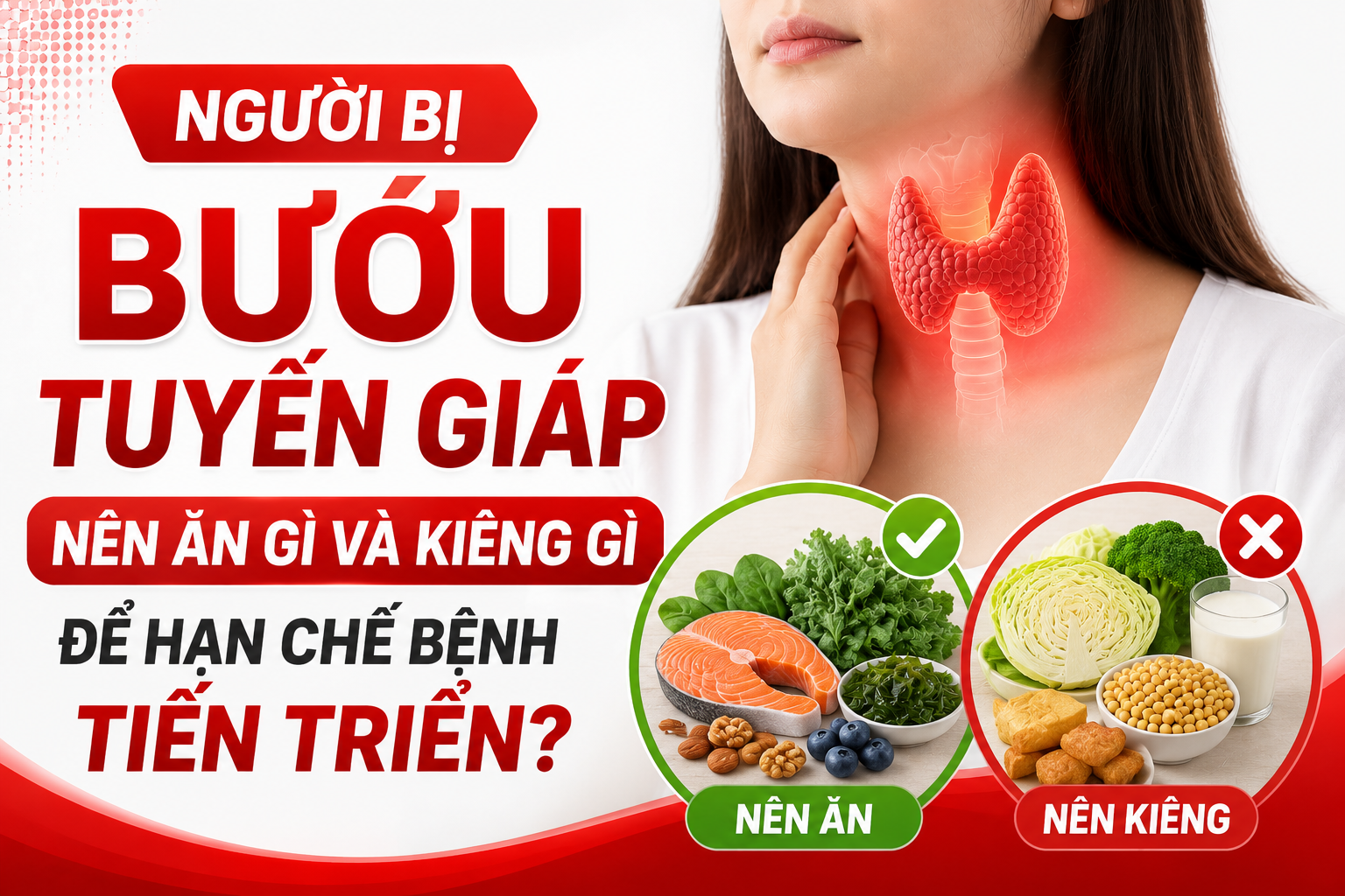 Người bị bướu tuyến giáp nên ăn gì và kiêng gì để hạn chế bệnh tiến triển