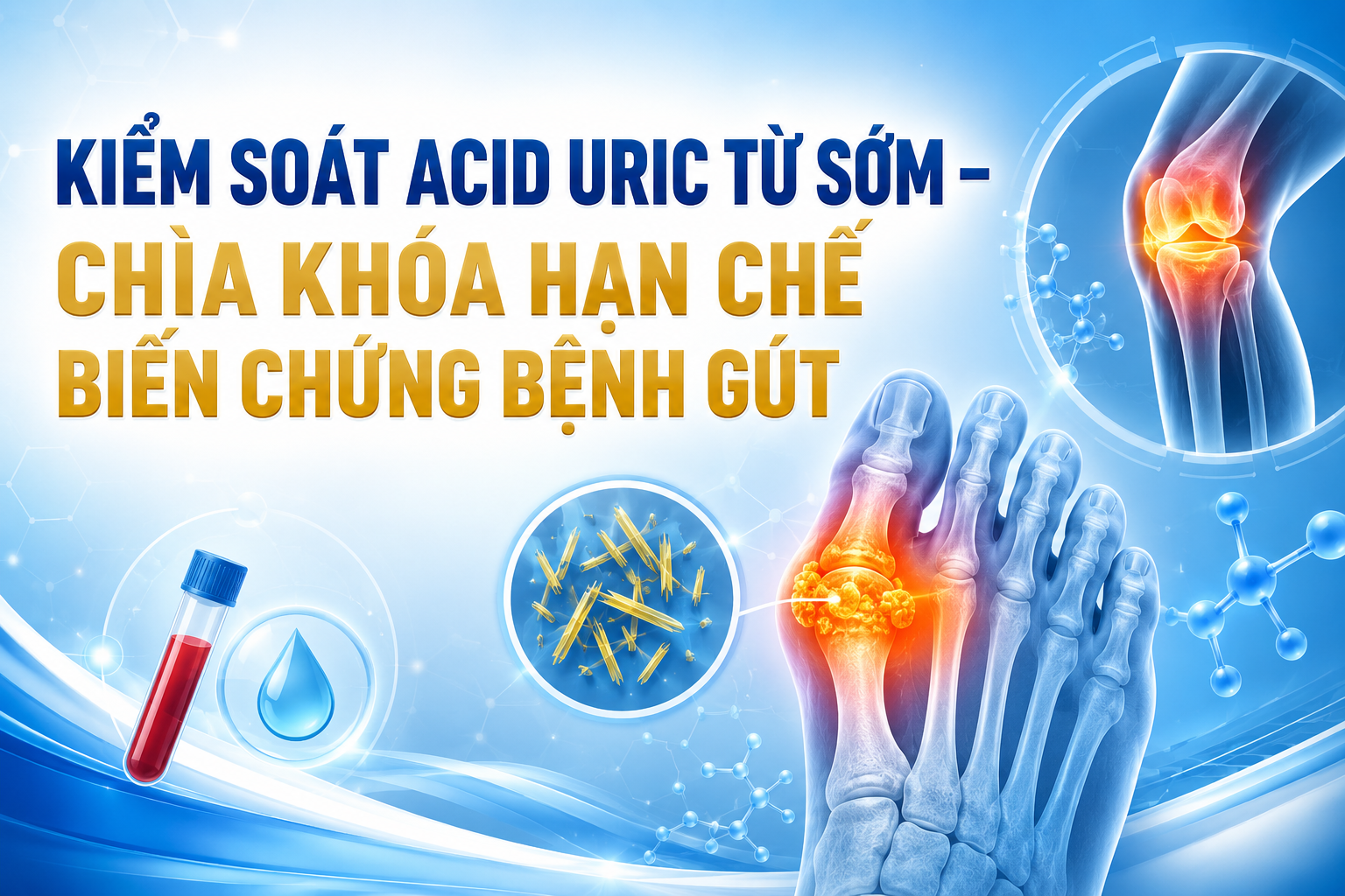 Kiểm soát acid uric từ sớm – Chìa khóa hạn chế biến chứng bệnh gút