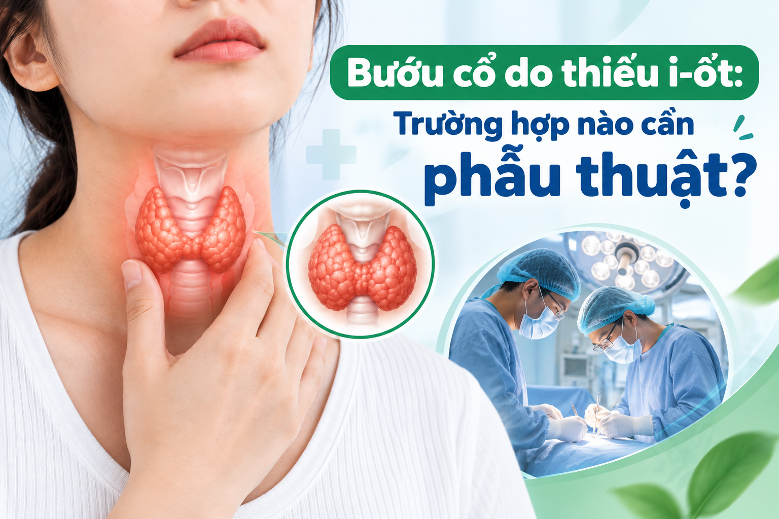 Bướu cổ do thiếu i-ốt Trường hợp nào cần phẫu thuật